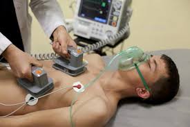 Hospital Initiative Reduced Time to First Shock for In-Hospital Cardiac  Arrests | DAIC