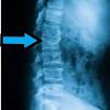 Only the backbone and cβ atom is shown for clarity. Https Encrypted Tbn0 Gstatic Com Images Q Tbn And9gcsmeirj46drh3bvgz8gh8fwwvfcc38w0qkcpe 4ductsyolll2l Usqp Cau