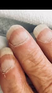 What is the significance of Terry's or Lindsay's nails in my ...