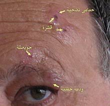 Check spelling or type a new query. Ù‡Ø±Ø¨Ø³ Ù†Ø·Ø§Ù‚ÙŠ ÙˆÙŠÙƒÙŠØ¨ÙŠØ¯ÙŠØ§
