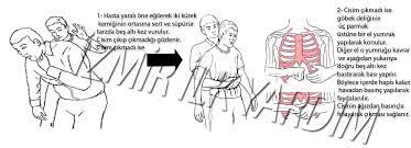 Heimlich manevrası nedir, nasıl uygulanır, boğulma i̇lk yardım. Heimlich Manevrasi Nedir Nasil Yapilir Izmir Ilk Yardim Egitimi Ilk Yardim Kursu Ilkyardim Egitim Ilkyardim Egitimi