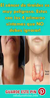 Saludynoticias Info Health Health Remedies Healthy Tips
