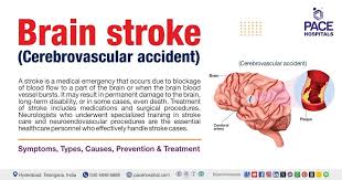Bildergebnis für CVA