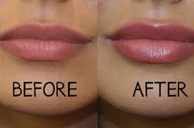 Maybe you would like to learn more about one of these? 11 Ways To Get The Smoothest Softest Fullest Lips Ever