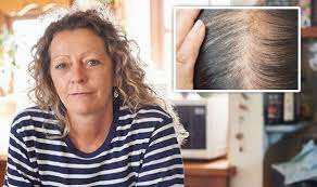 Does menopause increase hair loss or thinning in women? Hair Loss Treatment Hormone Scalp Drops Can Improve Hair Density In Menopausal Women Express Co Uk