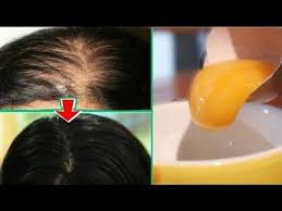 Tek Yumurta Sarisina Bunu Ekle Sac Dokulmesini Aninda Durdur Sac Cikartan Sac Gurlestiren Yontem Youtube Sac Sac Dokulmesi Yumurta