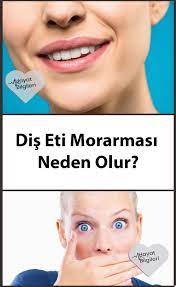 Dis Eti Morarmasi Neden Olur Hayat Bilgileri Dis Saglik Saglikli Yasam