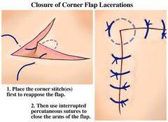 Image result for Corner Stitch