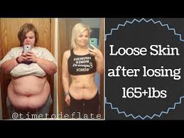 Pin On Healthy Living