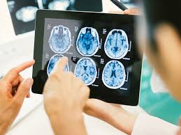 Early signs of a baby with brain damage. Brain Tumor Types Risk Factors And Symptoms
