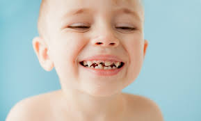 Early Preventive Dental Care for Children