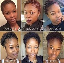 I have thinning hair on top. Castor Oil For Hair Growth Its Uses And Benefits