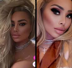 Stacey's Ab-Etching and Brow Lift Surgery Results