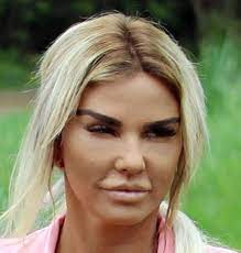 Subscribe to my youtube channel 👇💕. Katie Price S Swollen New Face Revealed After Her Third Facelift In Turkey
