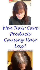 How To Use Monistat For Hair Loss Increased Hair Loss Before Period Colon Cleanse For Hair Loss Baby Hair Loss Men Hair Loss Medication Hair Loss Specialist
