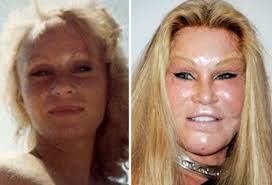 West has seemingly never come to terms with how his mother died, much the … Do Celebs Sometimes Go Too Far With Plastic Surgery Answer Angels