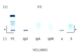 Ifeu stock price chart interactive chart >. Hellabio Ife01 Ife D01 Ifeu Immunofixation