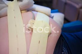 The test involves attaching one belt to the mother's abdomen to measure fetal heart rate and another belt to measure contractions. Fetal Non Stress Test Nst Stock Photos Freeimages Com