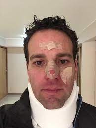 Descubre lo que mauricio loret de mola (mauricioloretdemola) encontró en pinterest, la colección de ideas más grande del mundo. Video Asi Quedo Carlos Loret De Mola Tras Accidente Jugando Beis Diario La Voz Del Sureste