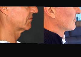 Andrew Jacono, MD, FACS