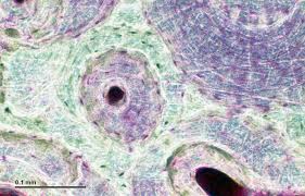 Cross section through an model of an normal upper right femur or leg bone. File Bone 254 02 Bird Bone Cross Section Jpg Wikimedia Commons