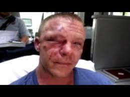 Beauty is never tarnished, made of iron Marine Gets Beat Down Trying To Stop Bullying Good Morning America Abc News Youtube