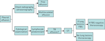Image result for Pleural Tuberculosis
