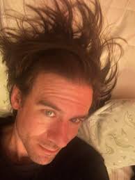 Healing Journey Through Artistic Creativity and Sheer Will