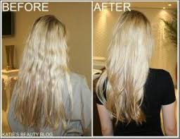The hair loss system also contains benzyl nicotinate, which in fact, the nioxin system hair care treatment is considered to be one of the best treatments for thinning hair. 7 Hair Loss Beauty Prevention Ideas Hair Loss Nioxin Hair