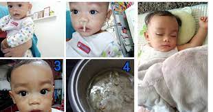 Bayi batuk akibat selsema dan sinus selalunya disertakan dengan kahak sekali. Teknik Stim Tepukan Percussion Bantu Keluarkan Hingus Pekat Anak Legakan Batuk Dan Selesema Pa Ma