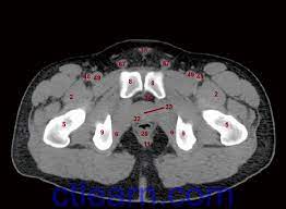 Check spelling or type a new query. Anatomy Ct Axial Abdomen And Pelvis Male