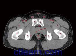 The muscular system is made up of specialized cells called muscle fibers. Anatomy Ct Axial Abdomen And Pelvis Male