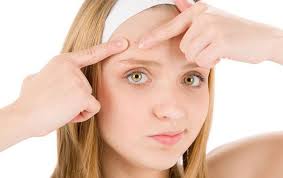 Sivilce Izleri Sizi Rahatsiz Ediyorsa Ve Evde Yapabileceginiz Bir Sivilce Izi Giderici Tedavi Ariyorsan Skin Care Acne Acne Treatment How To Get Rid Of Pimples