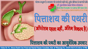 This procedure can help identify smaller stones that may be missed on an abdominal ultrasound. à¤ª à¤¤ à¤¤ à¤¶à¤¯ à¤• à¤ªà¤¥à¤° à¤¬ à¤¨ à¤'à¤ªà¤° à¤¶à¤¨ à¤†à¤¯ à¤° à¤µ à¤¦ à¤• à¤‰à¤ªà¤š à¤° Gallbladder Stones Without Operation Ayurvedic Treatment Health Care Friend