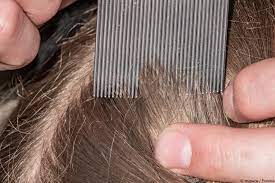 kopflause erkennen wie sehen kopflause aus wiado de