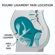 Round Ligament Pain In Pregnancy | Experts Explain