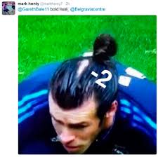 Bale apparently likes to sport lifted styles and cuts such as fohawks and quiffs which matches the shape of. Footballer Gareth Bale S Hair Loss Caught On Camera