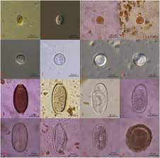Intestinal parasites cause significant morbidity and mortality. Parasites Identified In Stool Samples From Nhps A Giardia Sp B Download Scientific Diagram