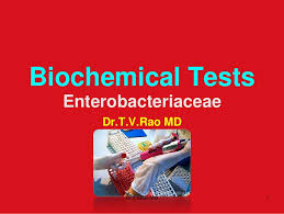 Biochemical Tests In Enterobacteriaceae