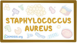 Image result for Staphylococcus Aureus
