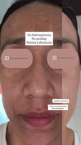 Selenederma (@dra.selenederma) • Instagram photos and videos