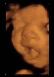 Desarrollo Fetal En El Octavo Mes De Embarazo Natalben