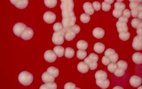 Image result for Staphylococcus Saprophyticus