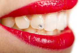 Affordable price and top quality, shop at walmart today! How Much Does It Cost To Put A Diamond In Your Teeth