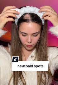 Combating Alopecia: My Golden Milk Journey