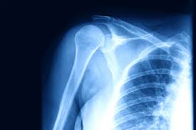 Image result for Shoulder Imaging
