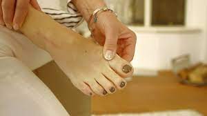 Hallux Rigidus Wenn Jeder Schritt Zur Qual Wird Gesundheit Br Fernsehen Fernsehen Br De