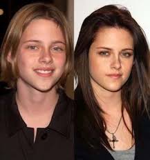 Chatter Busy Kristen Stewart Plastic Surgery Plastic Surgery Tips News Secrets Plastic Surgery Hair Implants Celebrity Plastic Surgery