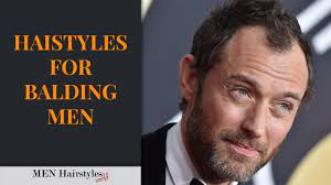 Balding No Problem At All With These 50 Hairstyles Video Men Hairstyles World