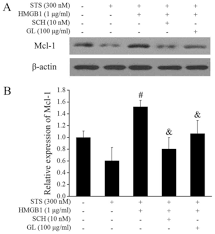 glycyrrhizin affects monocyte migration and apoptosis by